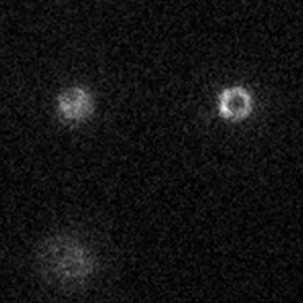 Comparison of live cell imaging of FtsZ ring organization during bacterial cell division using a Prime BSI and an EMCCD camera.
