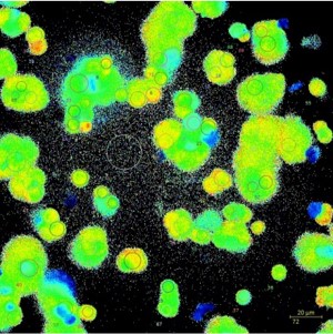 Time lapse of Fura-2 imaging in mouse pancreatic acinar cells. 